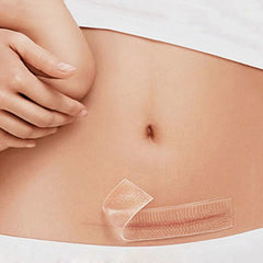 Cinta de Silicona Eliminación Cicatrices LB0889 Parches sin Dolor