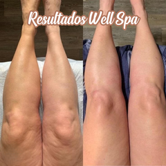 Tecnología corporal Wellspa