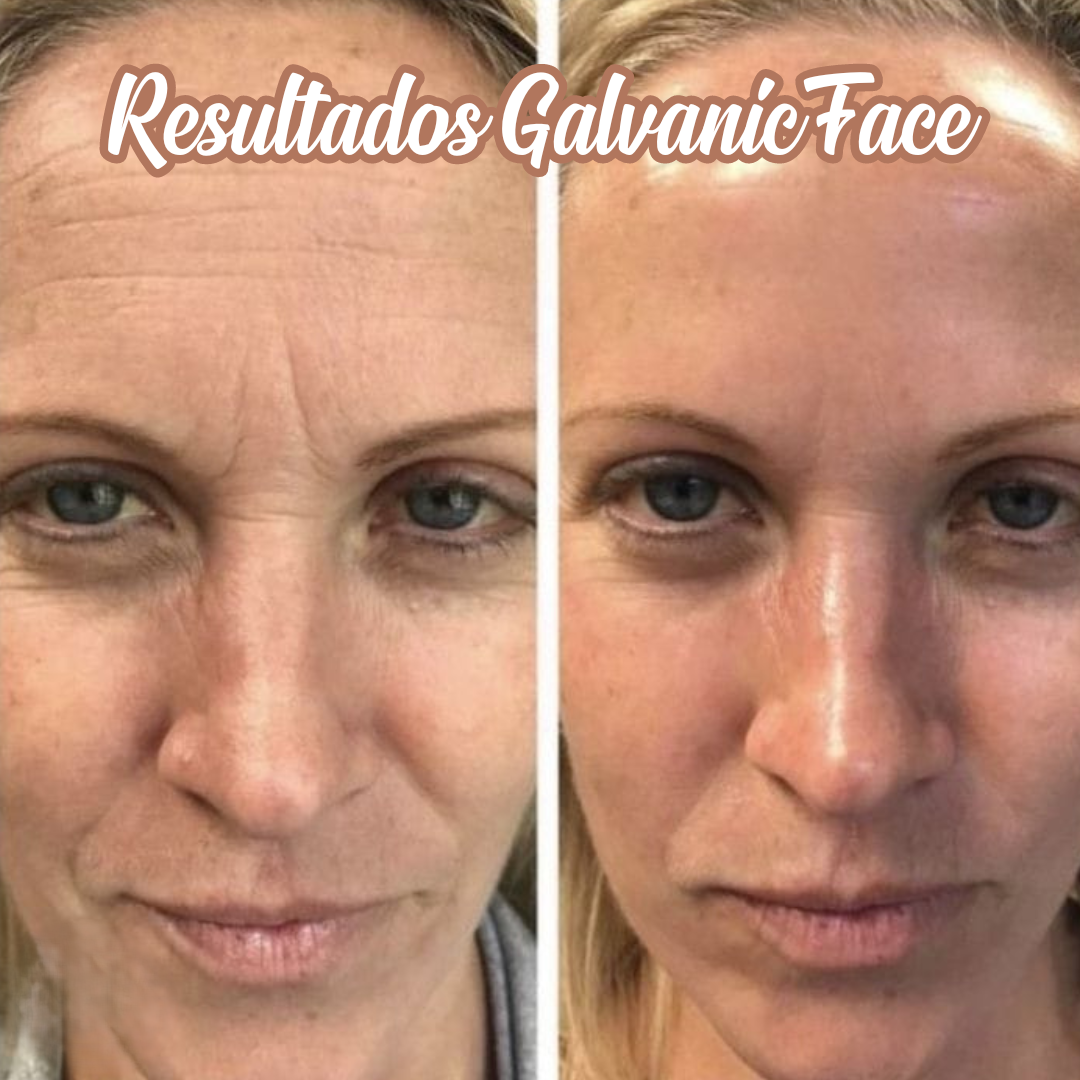 Máquina Galvánica Facial