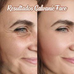 Máquina Galvánica Facial