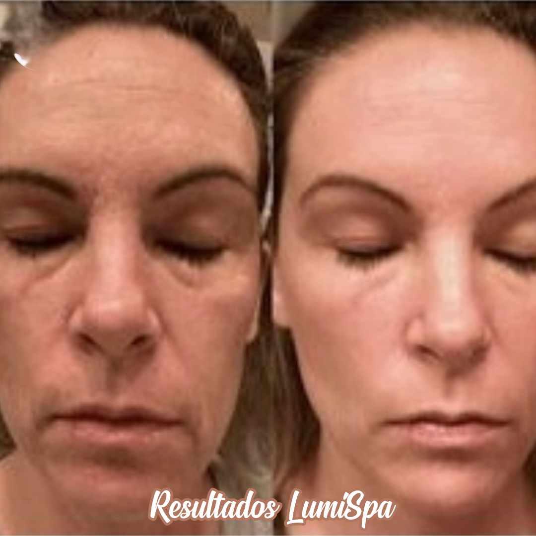 Máquina limiadora facial Lumi Spa