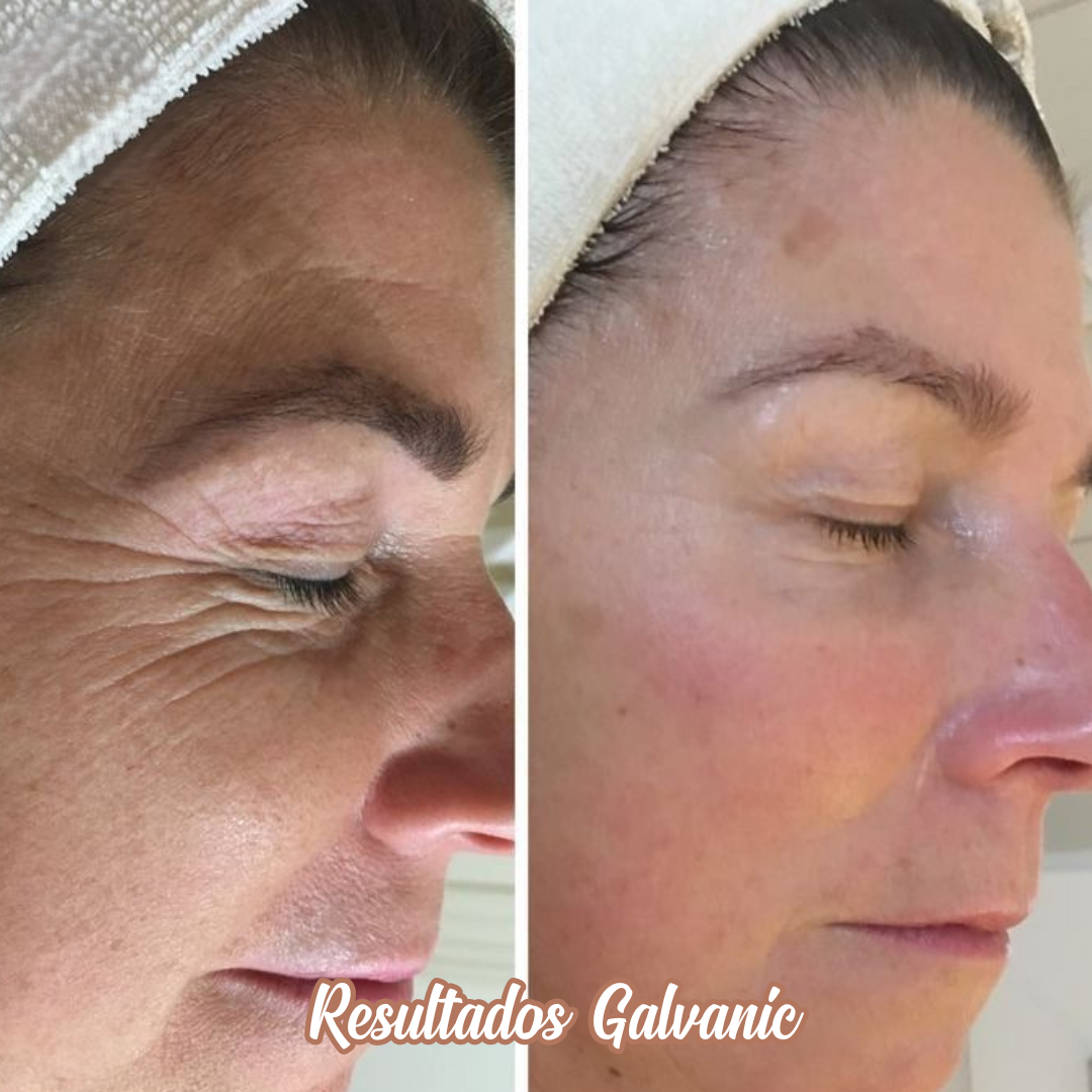 Máquina Galvánica Facial