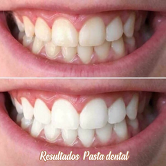 Pasta dental blanqueadora Ap24