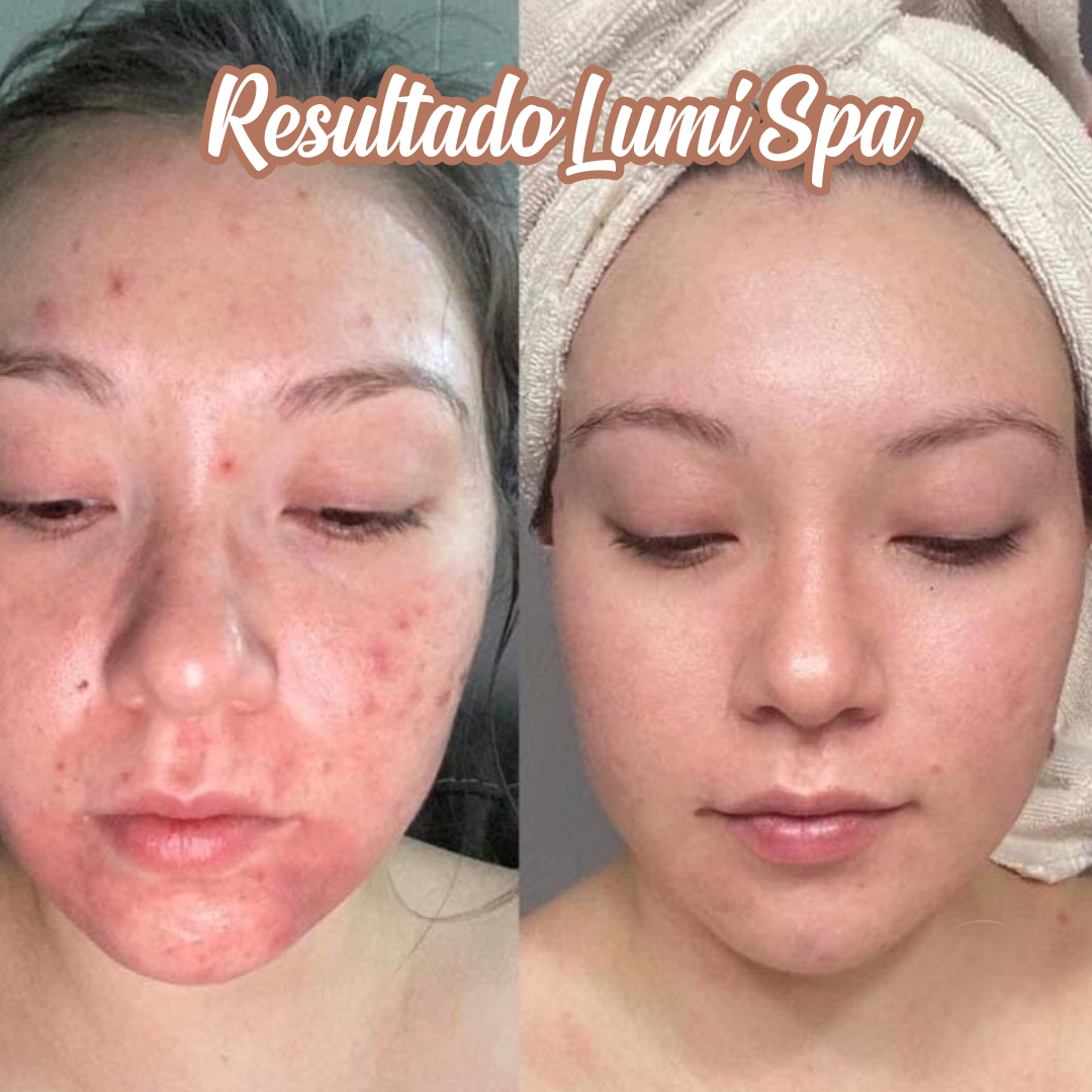 Máquina limiadora facial Lumi Spa