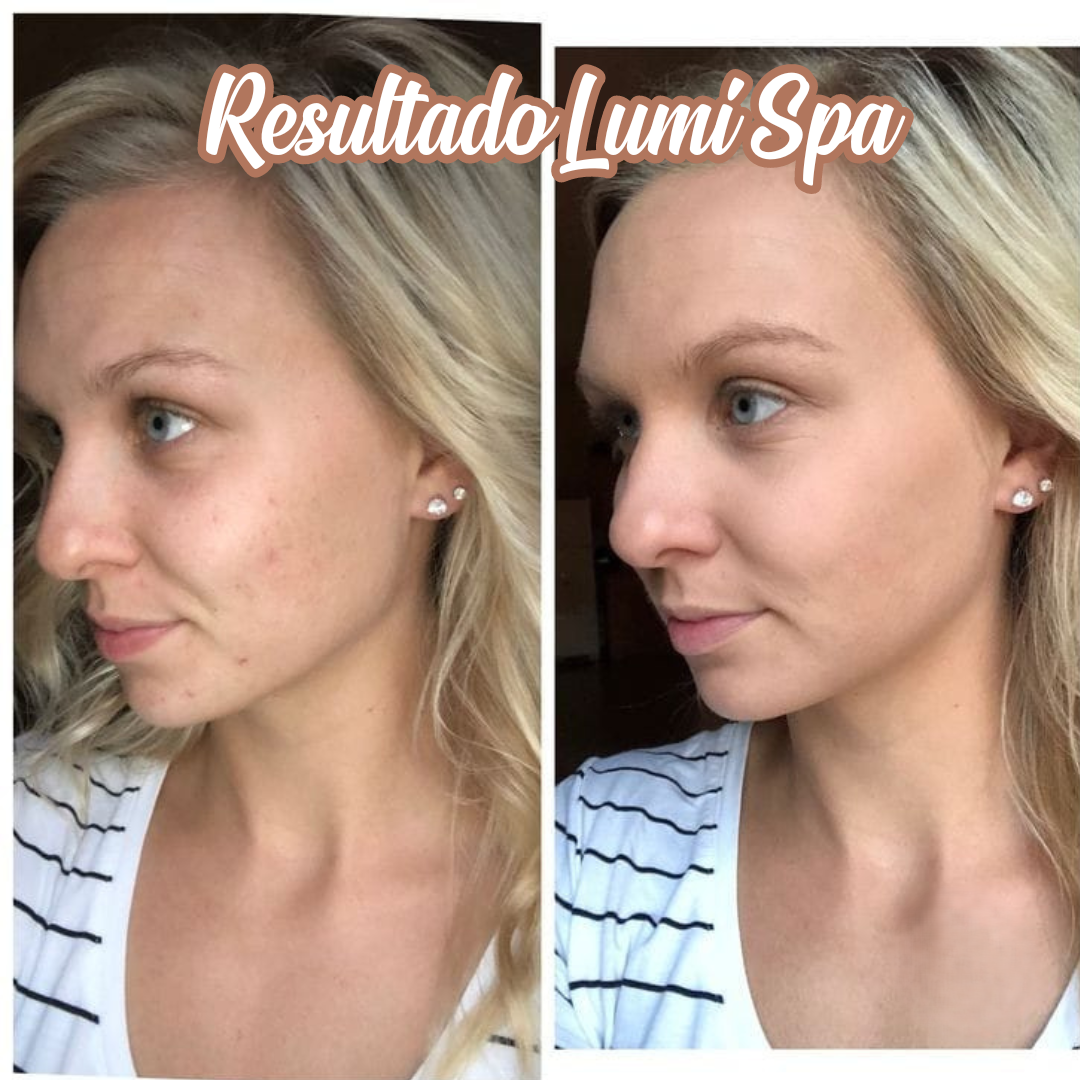 Máquina limiadora facial Lumi Spa